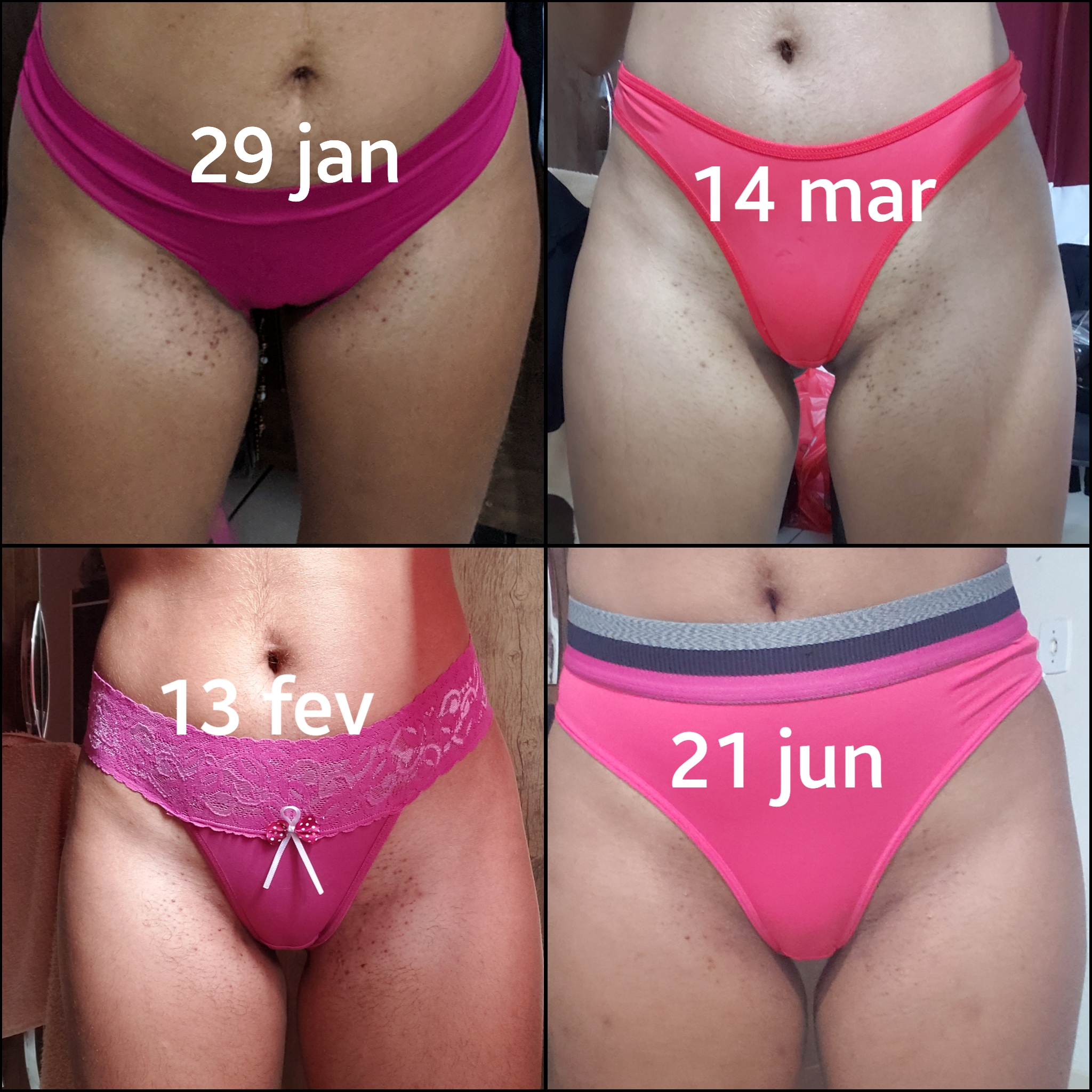 Comparativo completo Tend Skin antes e depois — múltiplas regiões do corpo com resultados reais